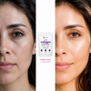 Colágeno Multifuente con Biotina y Ácido Hialurónico